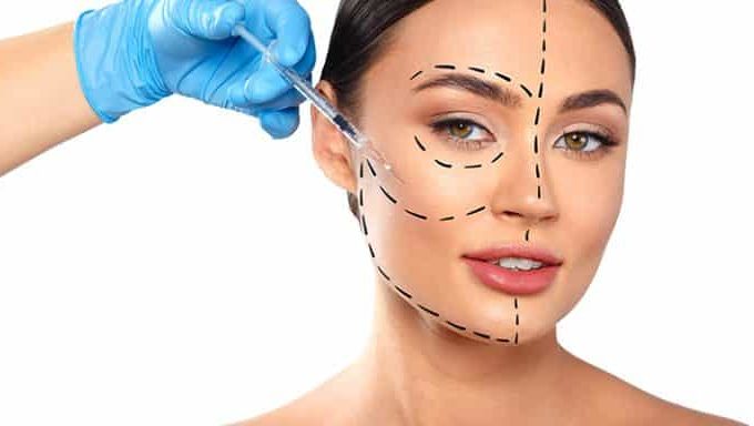 Lipofilling-du-visage-1-768x384